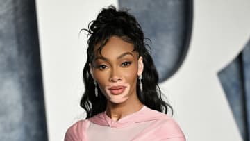 Winnie Harlow.