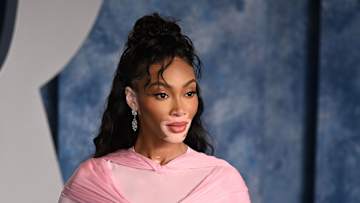 Winnie Harlow.