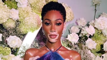 Winnie Harlow.