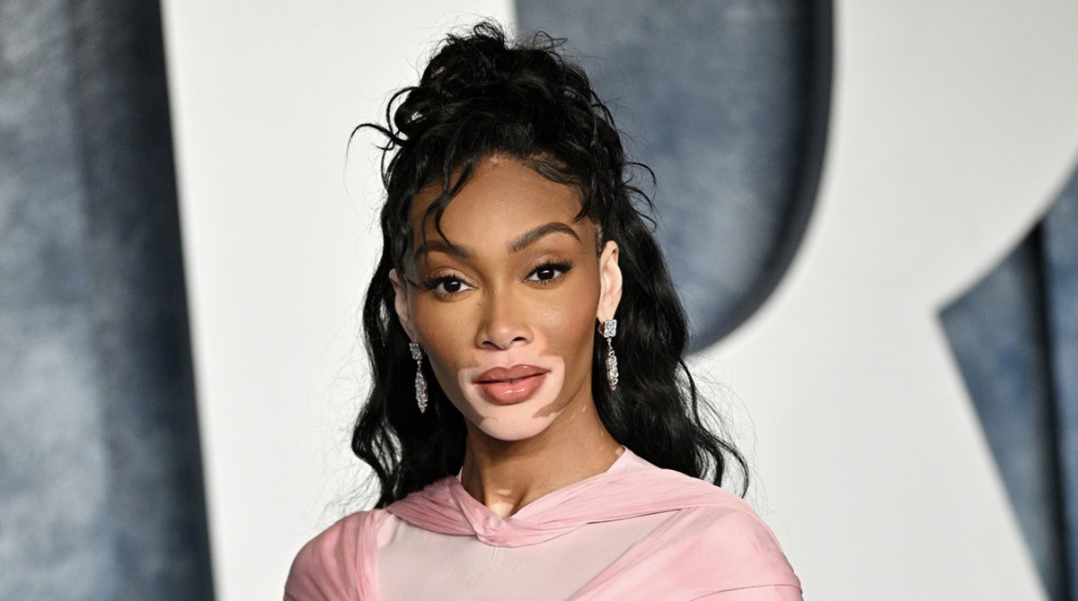 Winnie Harlow.